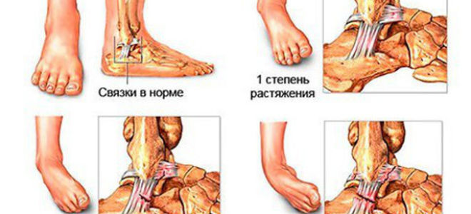 Голеностопный сустав