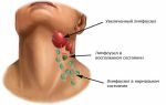 Болит лимфоузел на шее слева под челюстью: причины и лечение