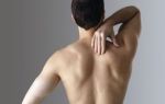 Лечение хондроза плечевого сустава: медикаменты, массаж, лфк, народные средства
