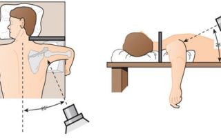 Мрт плечевого сустава: как делают, что показывает, расшифровка