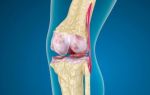 Боль в колене сбоку с внешней стороны: почему болит колено?