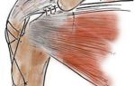 Видео: переломы проксимального отдела плечевой кости. а.а. волна (москва)
