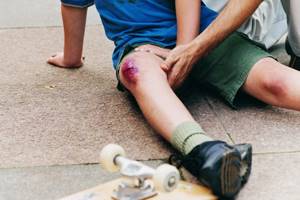 Боль в колене при ходьбе по лестнице: причины, как лечить