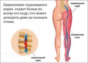 Болят ноги от колена до ступни: причины боли спереди, сбоку, сзади