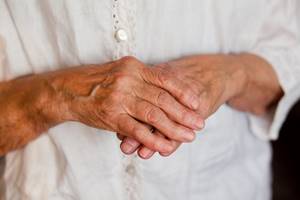 Деформирующий артроз кистей рук: симптомы и лечение