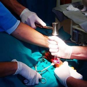 Эндопротезирование голеностопного сустава: показания, операция и реабилитация