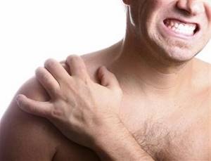 Артроз плечевого сустава: лечение в домашних условиях народными средствами