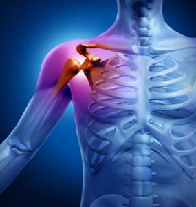 Периартрит плечевого сустава: лечение, симптомы, причины