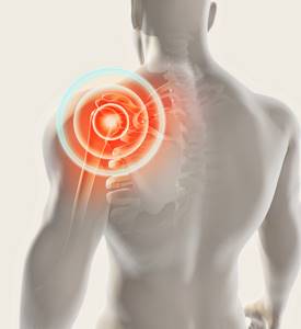 Адгезивный капсулит плечевого сустава: симптомы замороженного плеча, диагностика, лечение