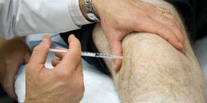 Список препаратов для лечения артроза коленного сустава: цена и качество