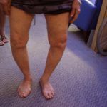 Почему щелкают суставы: разбор причины щелчков и их природы