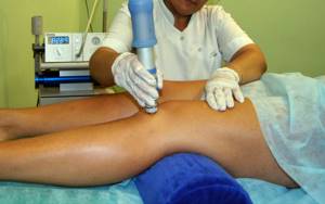 Пателлофеморальный артроз коленного сустава: симптомы и лечение