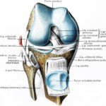 Посттравматический артрит суставов: как избежать, диагностировать и лечить