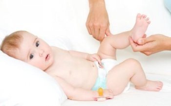 Дисплазия тазобедренного сустава у новорожденных: симптомы, лечение, причины