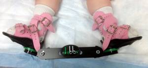 Ортопедическая обувь для детей при вальгусной деформации: виды, как выбрать