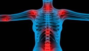 Болит спина в области лопаток: причины боли, диагностика