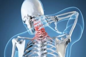 Симптомы шейного остеохондроза: все основные признаки болезни