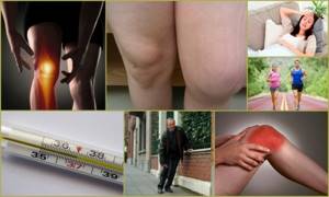 Контрактура коленного сустава: причины, симптомы и лечение