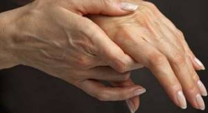 Ревматический артрит: симптомы, лечение, причины, что это такое