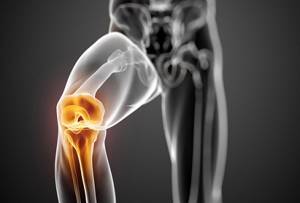 Периартрит коленного сустава: симптомы и лечение, причины, диагностика