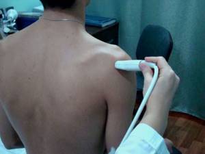 Адгезивный капсулит плечевого сустава: симптомы замороженного плеча, диагностика, лечение