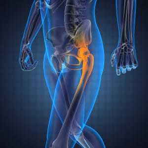 Боль в тазобедренном суставе при ходьбе: лечение, причины боли