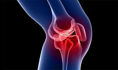 Бурсит коленного сустава: симптомы и лечение, что такое, профилактика 