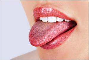 Жжение языка и онемение лица при шейном остеохондрозе: как лечить