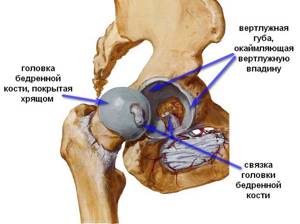 Боль в тазобедренном суставе: причины, лечение, что делать и как лечить