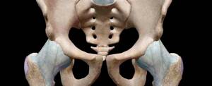 Коксартроз тазобедренного сустава: симптомы и лечение, причины, стадии
