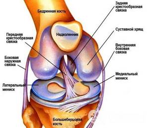 Остеоартрит коленного сустава: симптомы, стадии, лечение