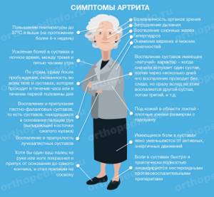 Артрит: симптомы и признаки, диагностика и лечение
