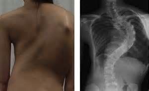 УЗИ плечевого сустава: отличия от рентгена, МРТ и КТ.