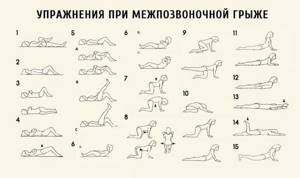 Последствия удаления межпозвоночной грыжи: виды осложнений