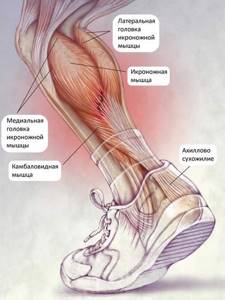 Лечение симптомов растяжение икроножной мышцы: реабилитация