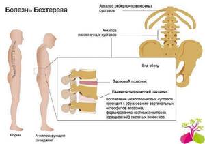 Болят суставы: лечение, причины появления боли в суставах