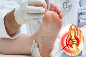 Болит большой палец на ноге в суставе: как лечить и чем, причины боли
