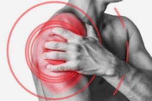 Разрыв связок плечевого сустава: симптомы и лечение