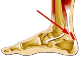Крутит суставы ног и рук: причины, меры лечения и последствия