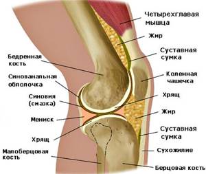 Болезнь Гоффа коленного сустава: лечение, симптомы, причины