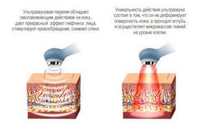 Артрит челюстно-лицевого сустава: симптомы и лечение, что это такое
