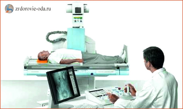 Рентген пояснично-крестцового отдела позвоночника: подготовка, как делают