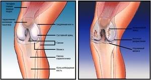 Боль в коленном суставе: причины, лечение, почему болят колени, что делать, как и чем лечить