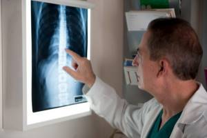 Остеопороз: какой врач лечит