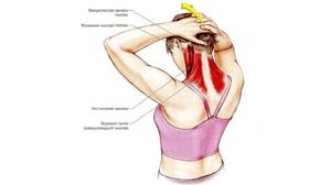 Растяжение мышц шеи: причины, симптомы, методы лечения