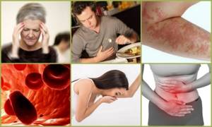 Антибиотики при воспалении, артрите и артрозе суставов и костей