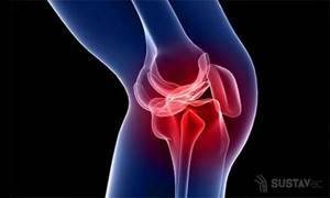 Мениск коленного сустава: симптомы и лечение повреждений