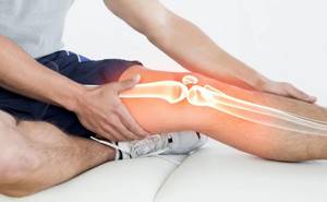 Посттравматический артроз суставов: причины, диагностика, лечение и профилактика