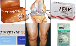 Список препаратов для лечения артроза коленного сустава: цена и качество