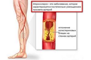 Болят ноги от колена до ступни: причины боли спереди, сбоку, сзади